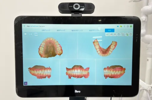 最新3Dスキャナーで
精密データ取得