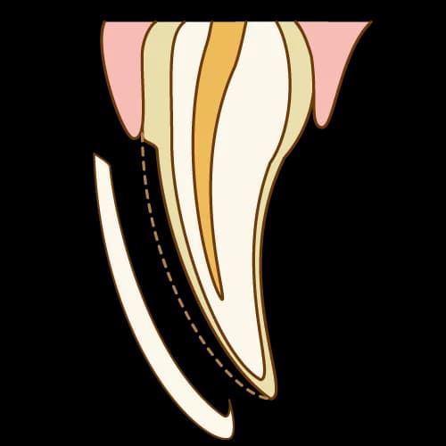 シェルを合わせる