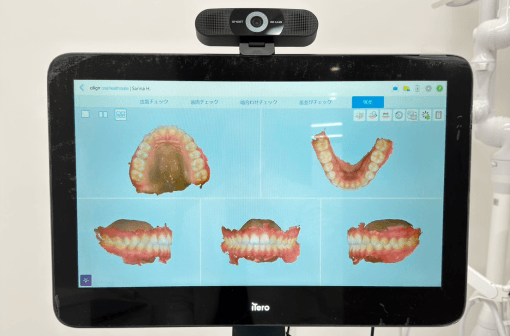 口腔内スキャナー iTero Lumina